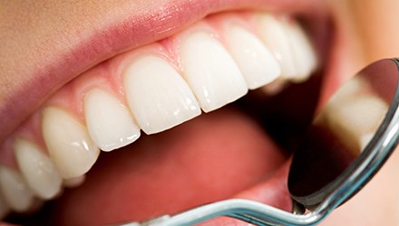 Closeup of healthy smile