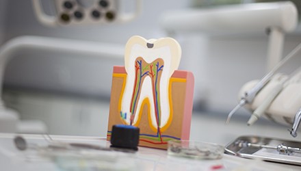 Model of the inside of a tooth