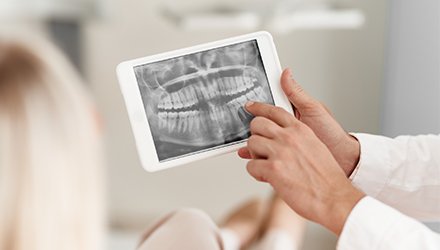 Digital x-rays on tablet computer