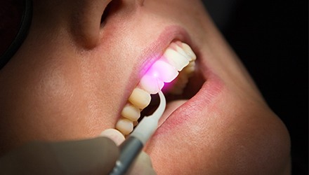 Patient receiving laser dentistry treatment